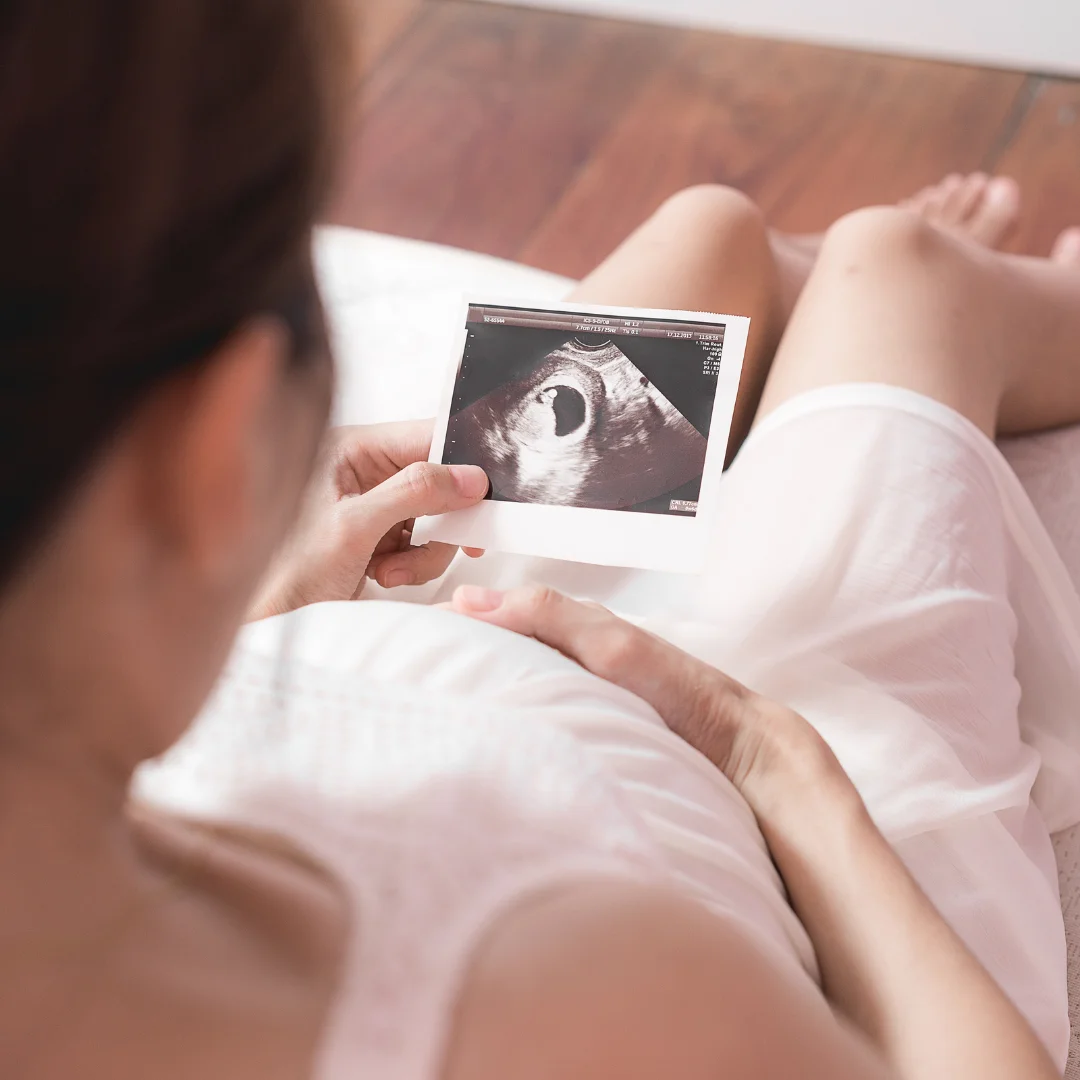 Happy pregnant woman | 3D BabyVision providing Ultrasound services at Tilbury, ON 