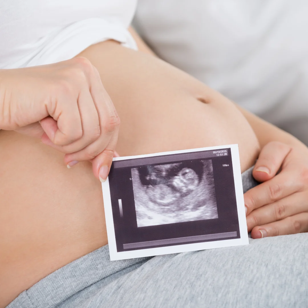 Happy pregnant woman | 3D BabyVision providing Ultrasound services at Leamington, ON