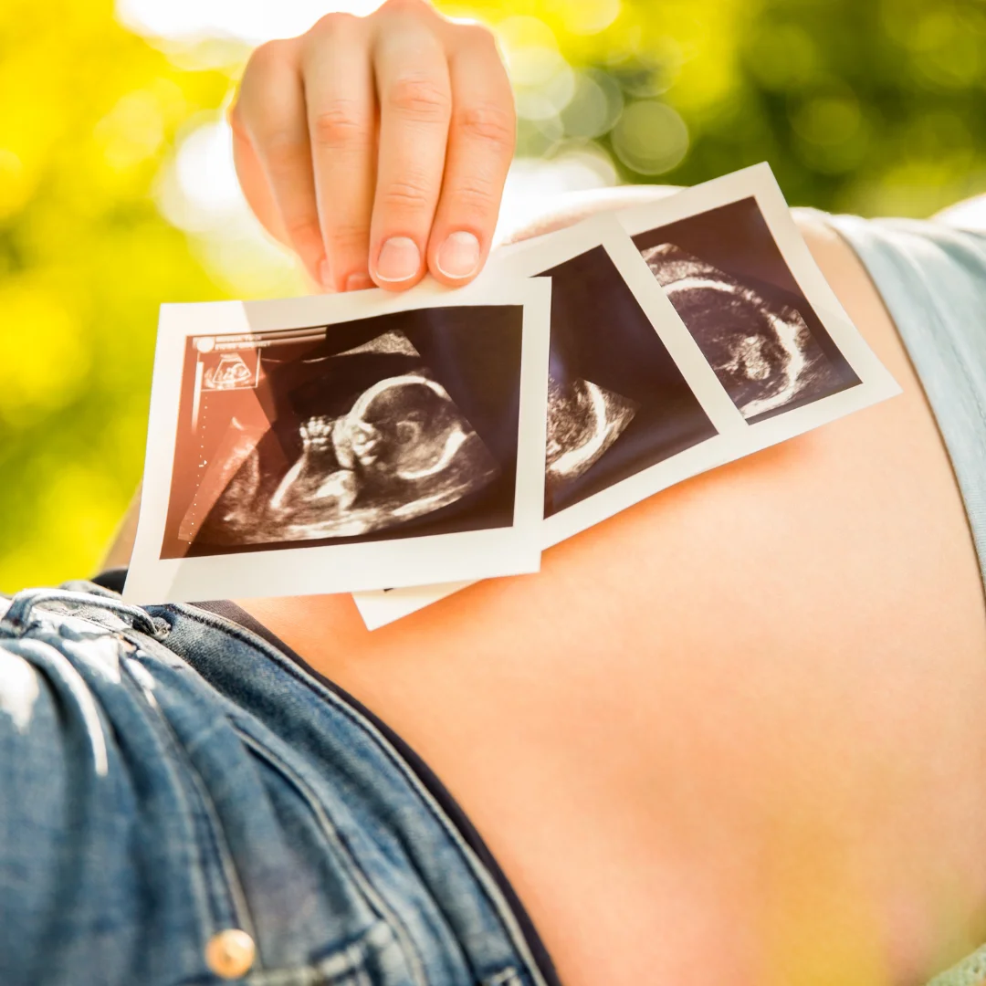 Happy pregnant woman | 3D BabyVision providing Ultrasound services at Forest Glade, Windsor, ON