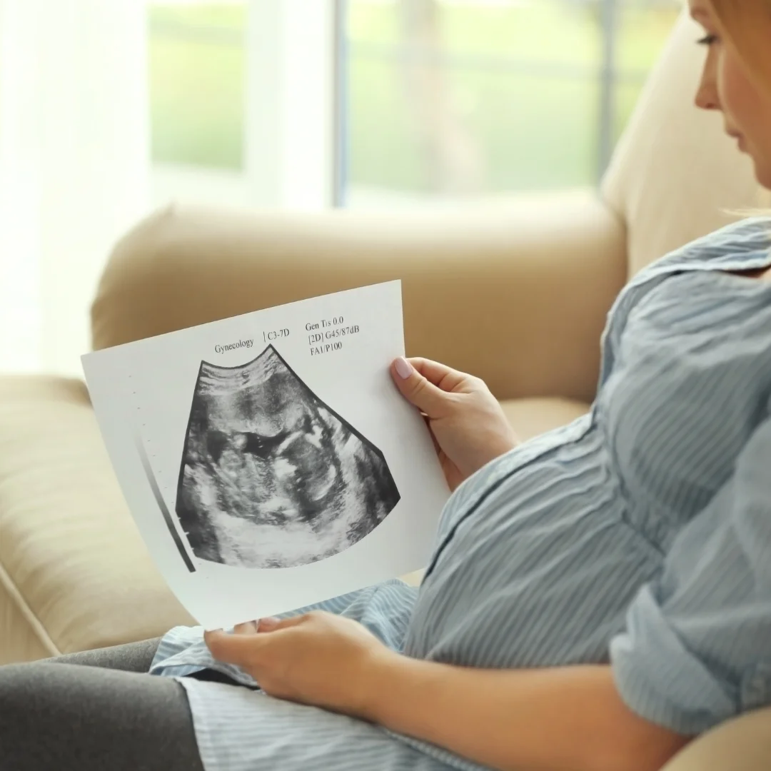 Happy pregnant woman | 3D BabyVision providing Ultrasound services at Essex, ON