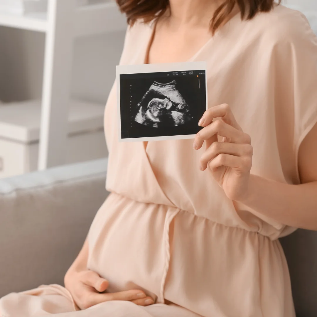 Happy pregnant woman | 3D BabyVision providing Ultrasound services at Fontainebleau, Windsor, ON