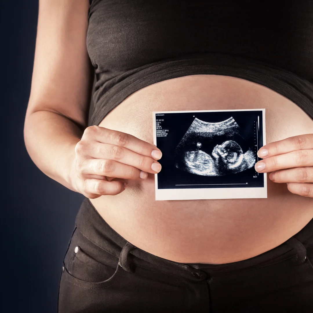 Happy pregnant woman | 3D BabyVision providing Ultrasound services at Thamesville, ON