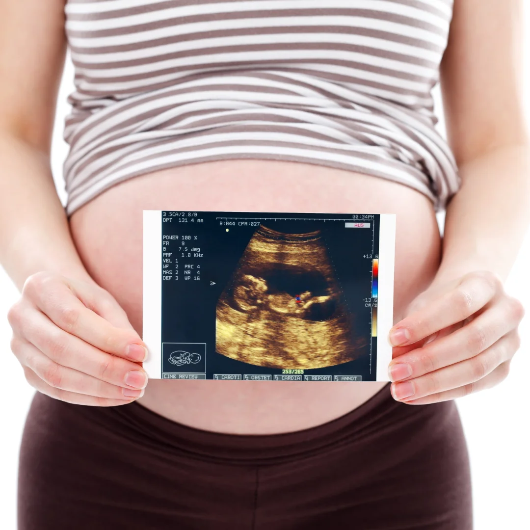 Happy pregnant woman | 3D BabyVision providing Ultrasound services at Morpeth, ON