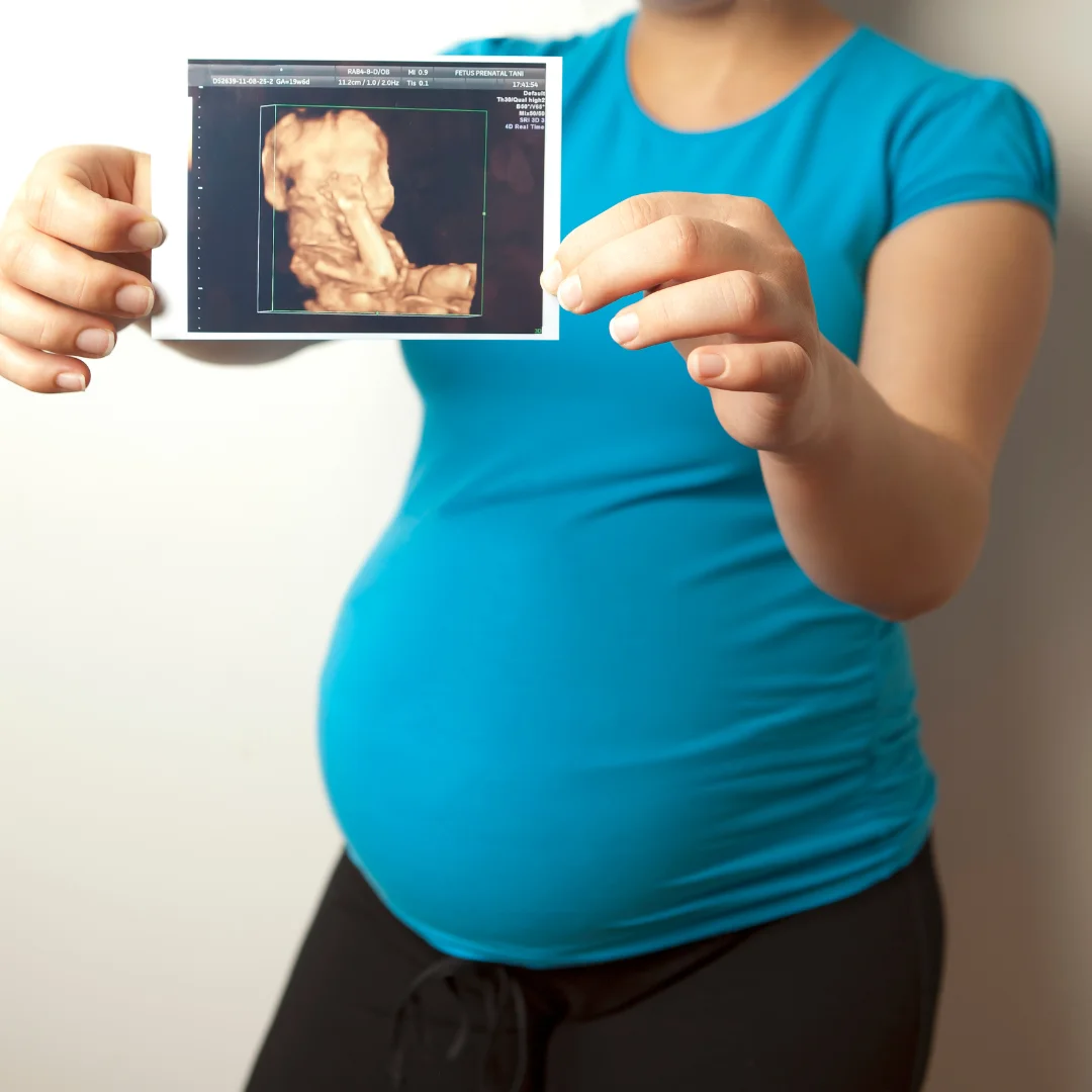 Happy pregnant woman | 3D BabyVision providing Ultrasound services at Walpole Island, ON