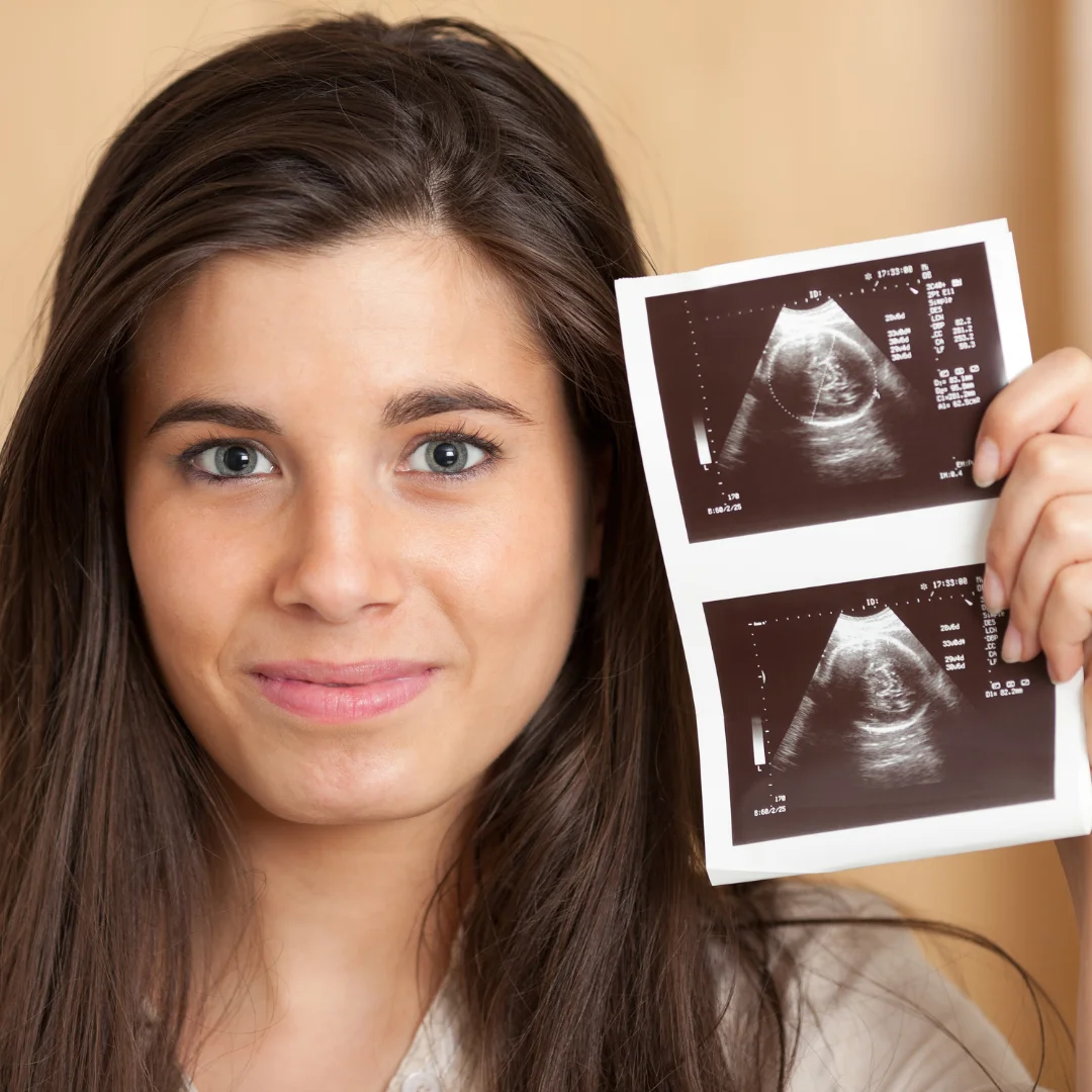 Happy pregnant woman | 3D BabyVision providing Ultrasound services at Banwell, Windsor, ON