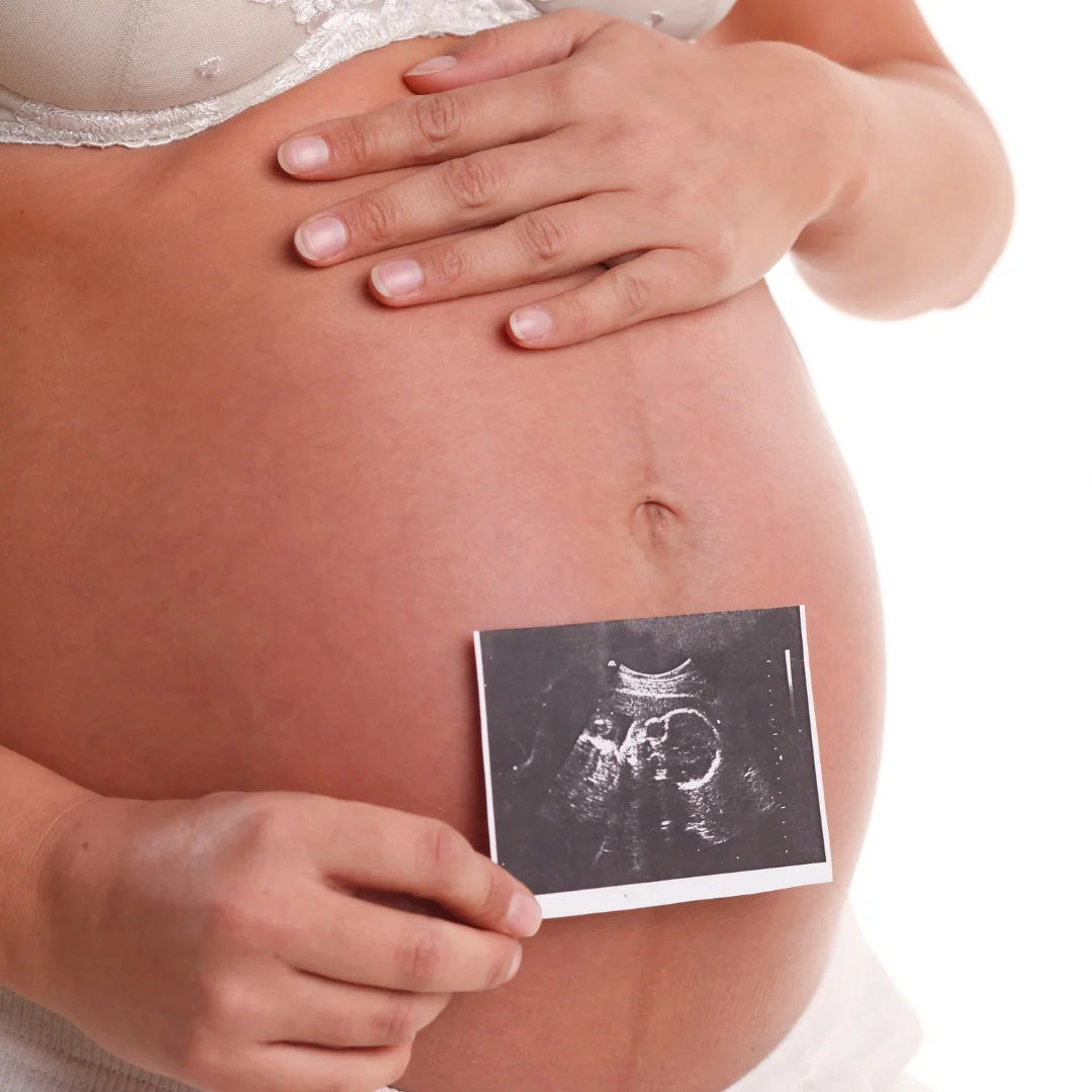 Happy pregnant woman | 3D BabyVision providing Ultrasound services at Little River Acres, Windsor, ON