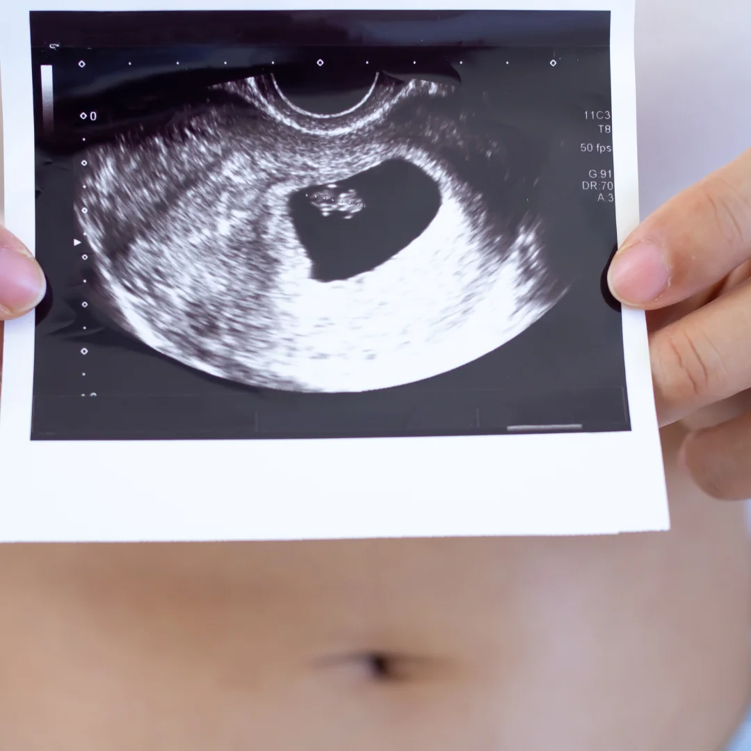 Happy pregnant woman | 3D BabyVision providing Ultrasound services at Tecumseh, ON