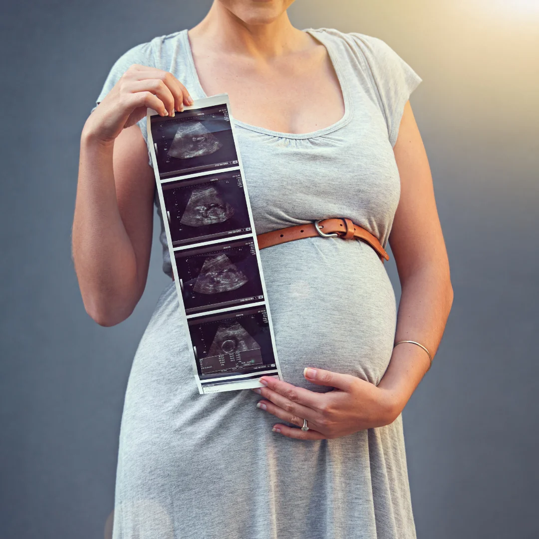 Happy pregnant woman | 3D BabyVision providing Ultrasound services at Lakeshore, ON