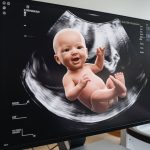 best 3D ultrasound services windsor