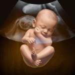 3D Ultrasound Scans for Babies