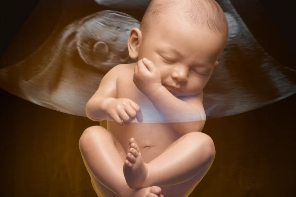 3D Ultrasound Scans for Babies